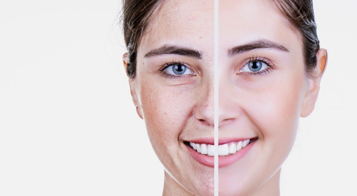 Tipos de faciales en un Spa