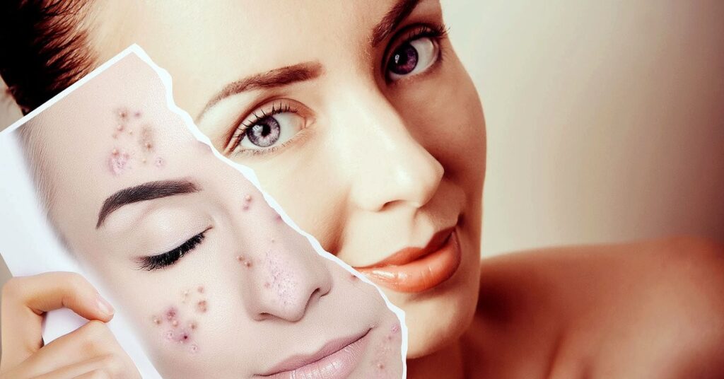 What is a facial treatment and why does it make such a noticeable difference?