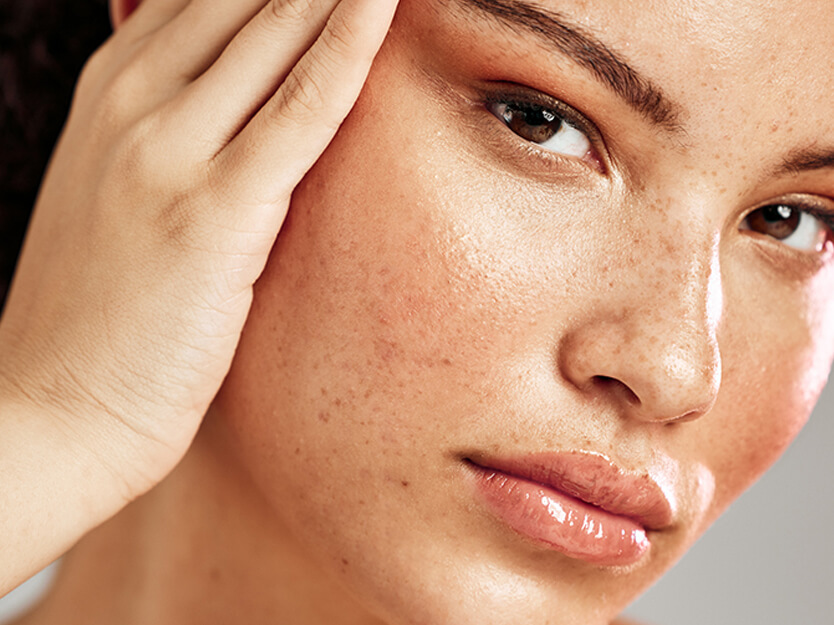 Does cleansing lighten the skin?