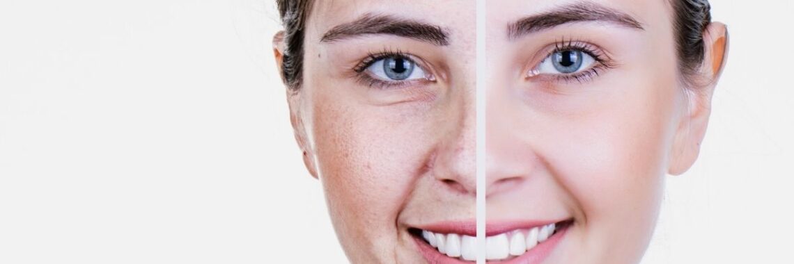 Types of facials at a spa